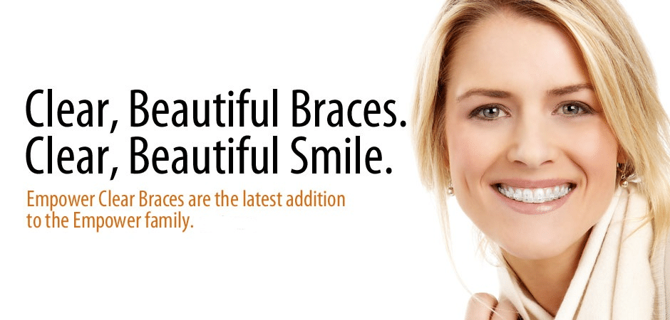 Clear Ceramic Braces in Chevy Chase MD